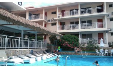 Vendo tiempo compartido VITALICIO  en  Acapulco, Hotel Condesa LUX